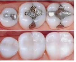 Palomos Dental Center - Dentists-Orthodontists