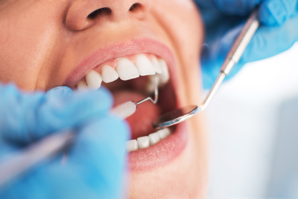 Tooth Haven Dental Studio - DENTAL-TEETH WHITENING